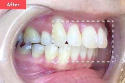 Case 01 After