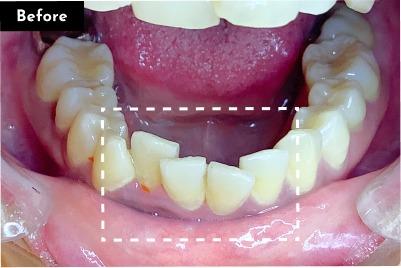 Case 04 Before